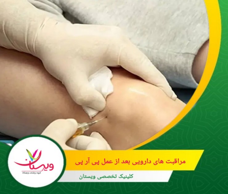 اگر داروهای خاصی مصرف میکنید، حتماً پزشک خود را مطلع کنید تا تداخلات دارویی احتمالی بررسی شود. مراقبت های دارویی بعد از عمل پی آر پی (PRP)