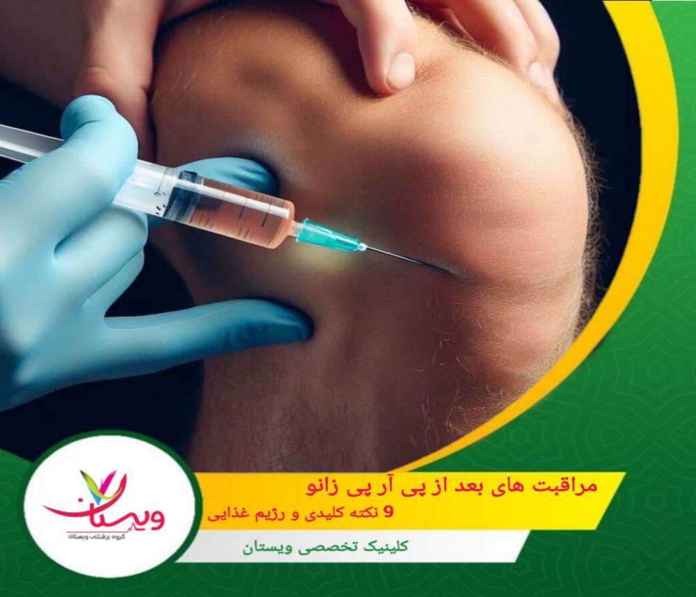 مراقبت های بعد از پی آر پی زانو | 9 نکته کلیدی و رژیم غذایی