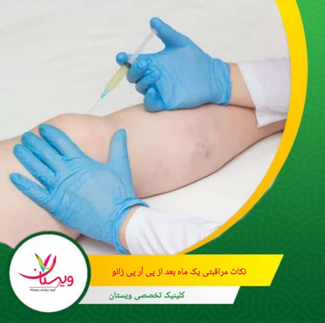 برای کاهش التهاب و درد باقیمانده، استفاده از کمپرس سرد به مدت ۱۵ تا ۲۰ دقیقه، چند بار در روز، توصیه میشود.