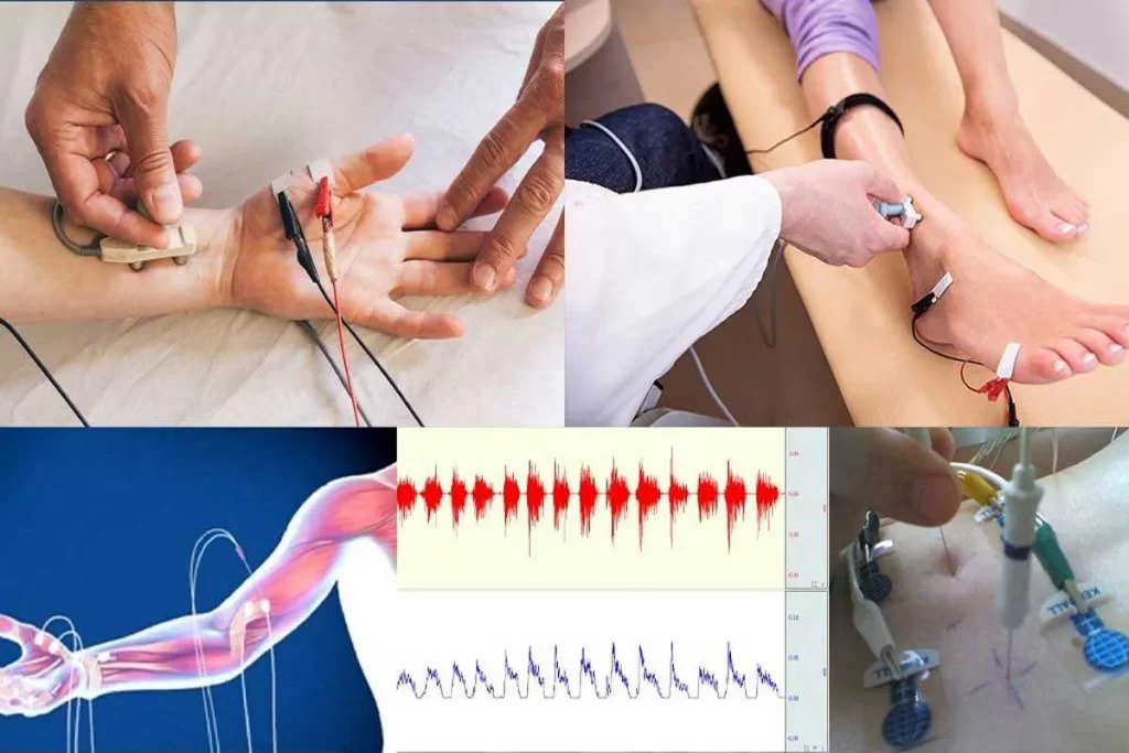 خدمات نوار عصب و عضله در تهران نوار عصب و عضله