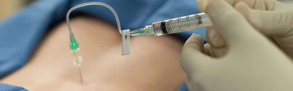 تزریق prp برای دیسک کمر