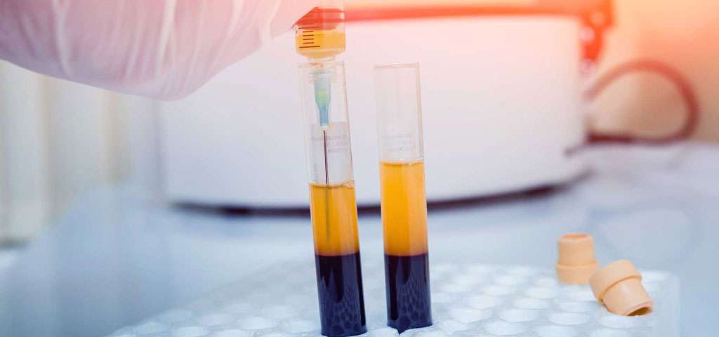 تزریق prp برای دیسک کمر