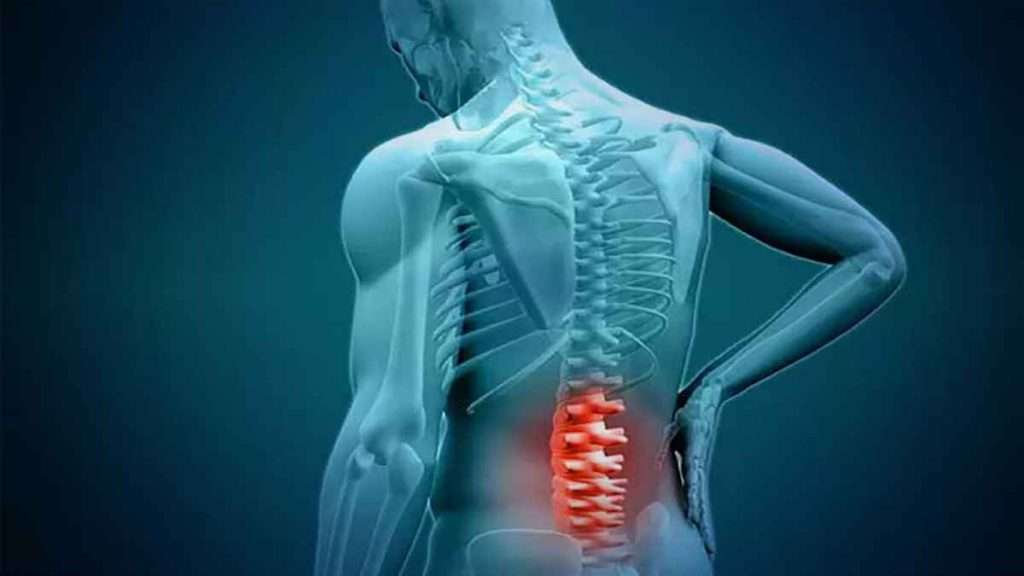 تشخیص و درمان دیسک کمر تشخیص دیسک کمر و سیاتیک