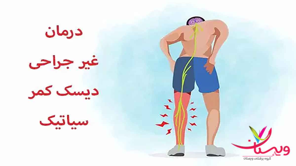 علائم دیسک کمر و سیاتیک بهترین دکتر دیسک کمر در تهران 1403 علائم دیسک کمر و سیاتیک بهترین دکتر دیسک کمر در تهران 1403