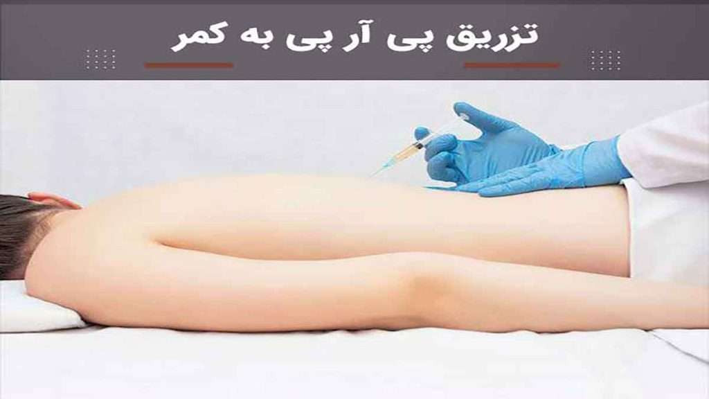 مراقبت بعد از پی ار پی تزریق پی ار پی به کمر