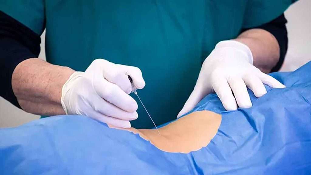 تزریق پی ار پی عوارض پی ار پی