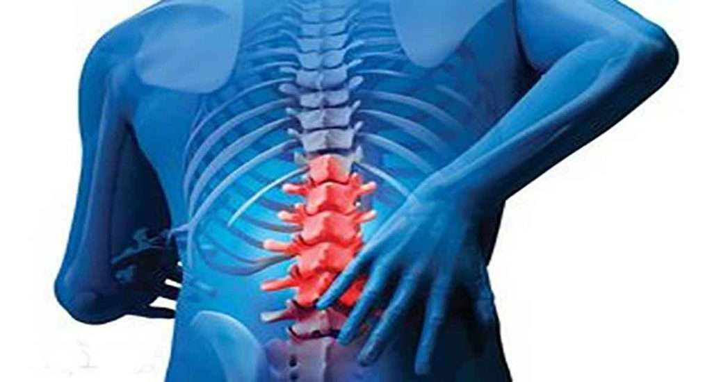 فیزیوتراپی و درمان دیسک کمر درمان دیسک کمر با فیزیوتراپی