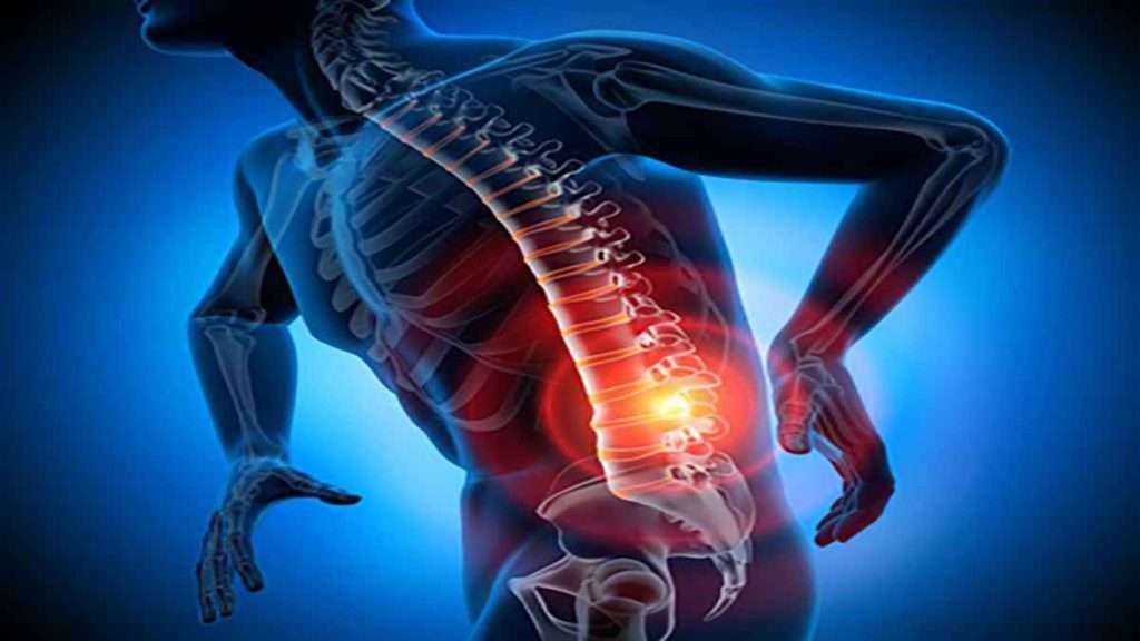 تشخیص دیسک کمر بهترین قرص برای کمر درد