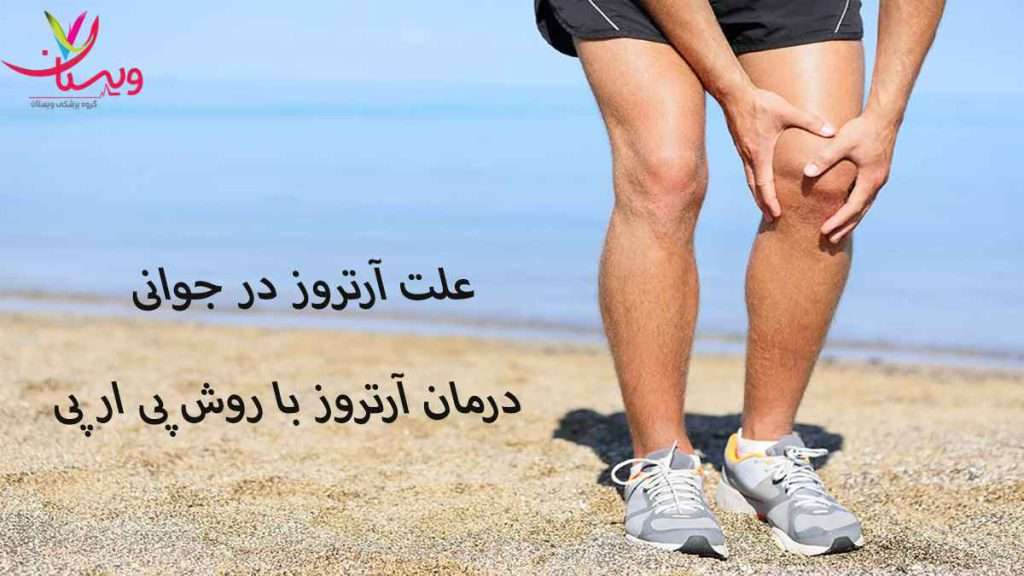 آرتروز در جوانی آرتروز زانو