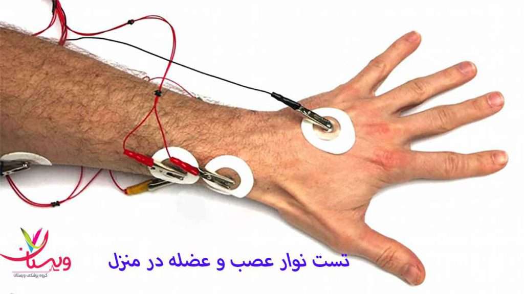 نوار عصب دست انجام نوار عصب در منزل
