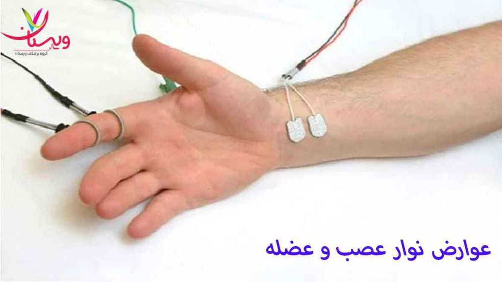 نوار عصب دست عوارض نوار عصب