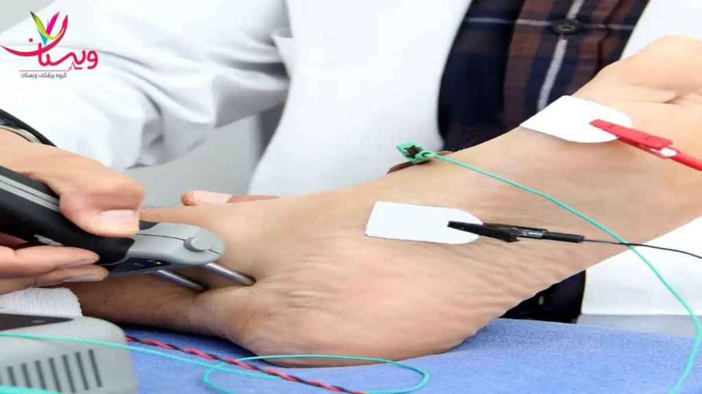 تست عصب و عضله پا مزایا تست emg