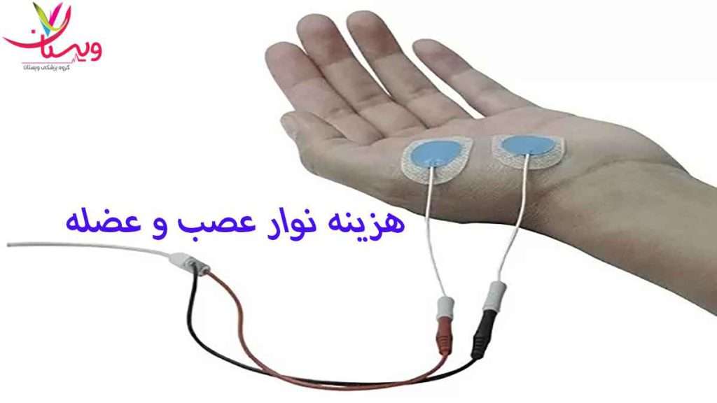 هزینه نوار عصب هزینه نوار عصب