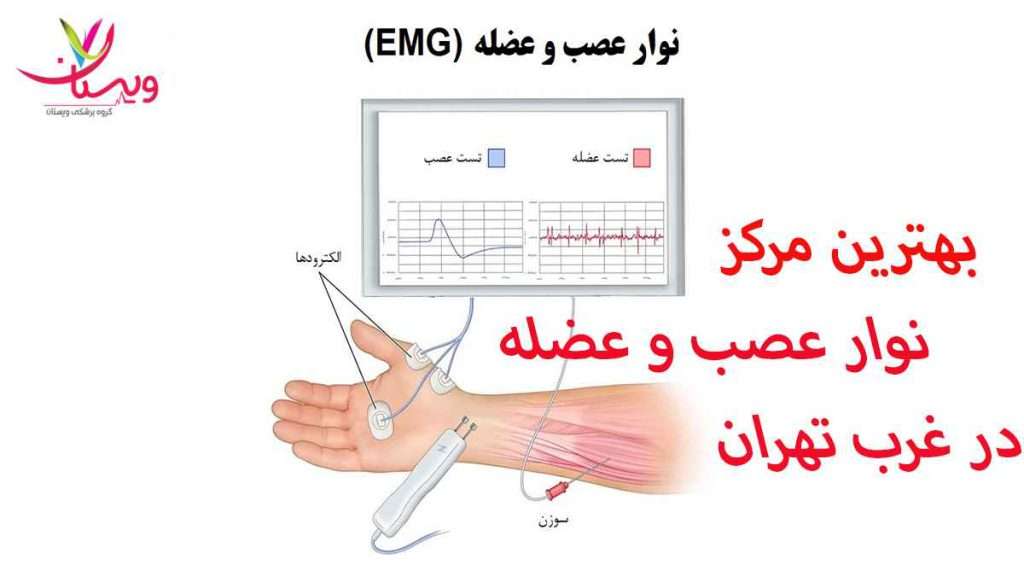 مرکز نوار عصب بهترین مرکز نوار عصب