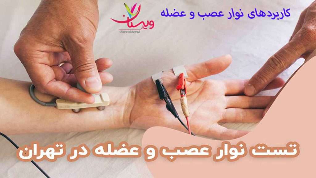 کاربرد نوار عصب کاربرد نوار عصب