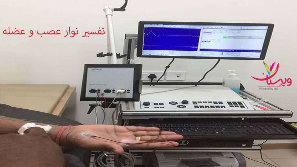 دستگاه نوار عصب تفسیر نوار عصب