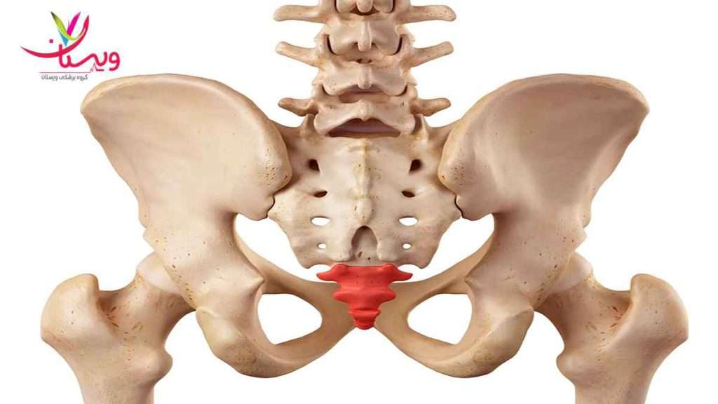 درد دنبالچه درمان درد دنبالچه