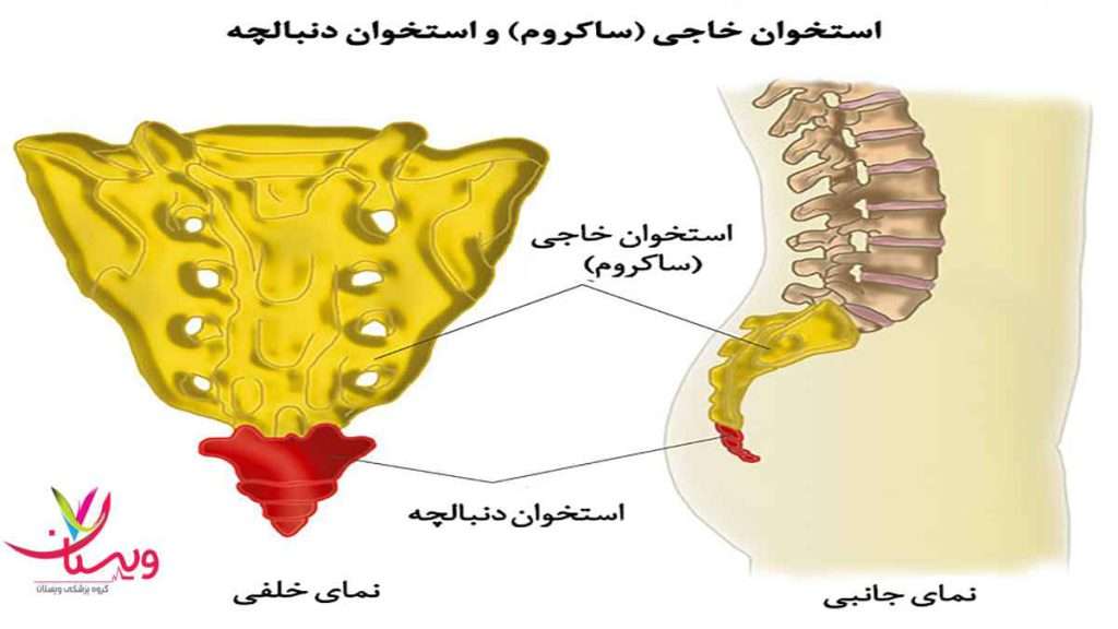 دنبالچه در رفتگی و شکستگی دنبالچه