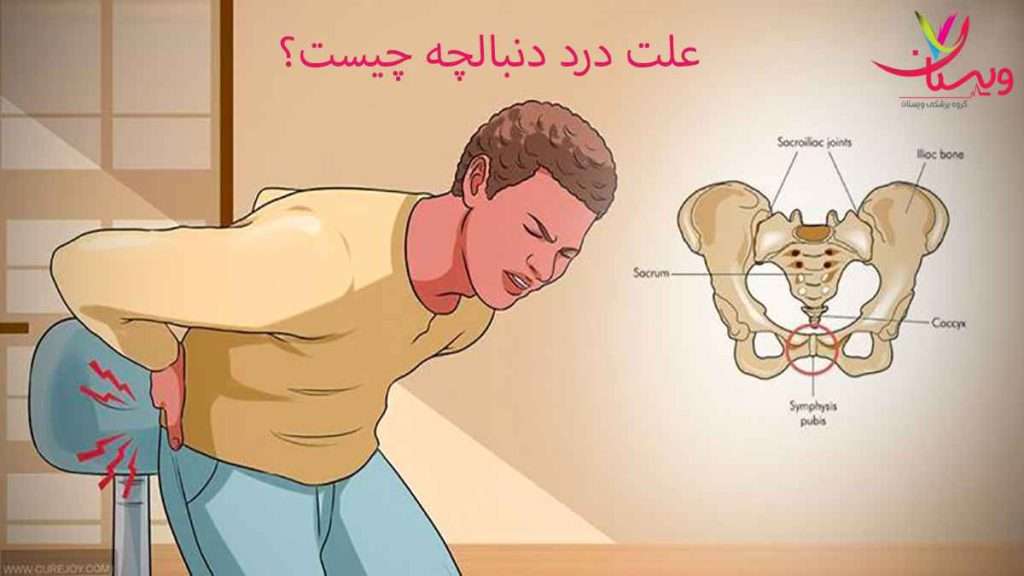 درد در قسمت دنبالچه علت در رفتن دنبالچه