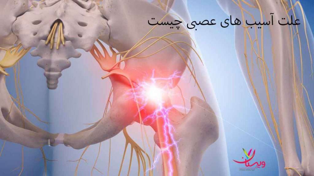 علت آسیب های عصبی علت آسیب های عصبی