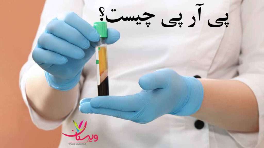پی ار پی چیست پی ار پی