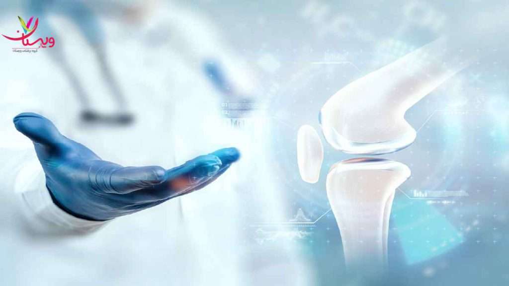 مفصل زانو بیماری های مفاصل