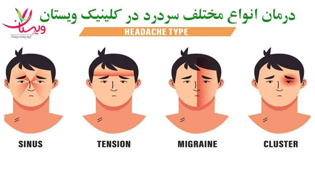انواع میگرن انواع میگرن