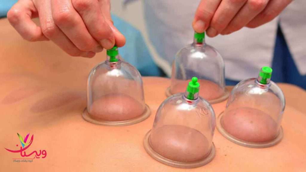 بادکش بادکش