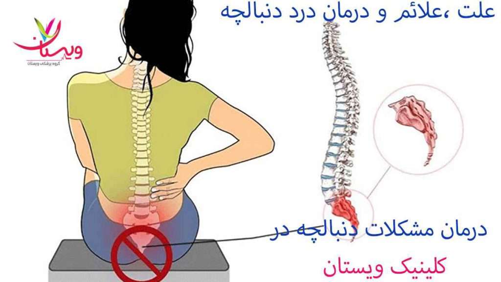 درمان درد دنبالچه