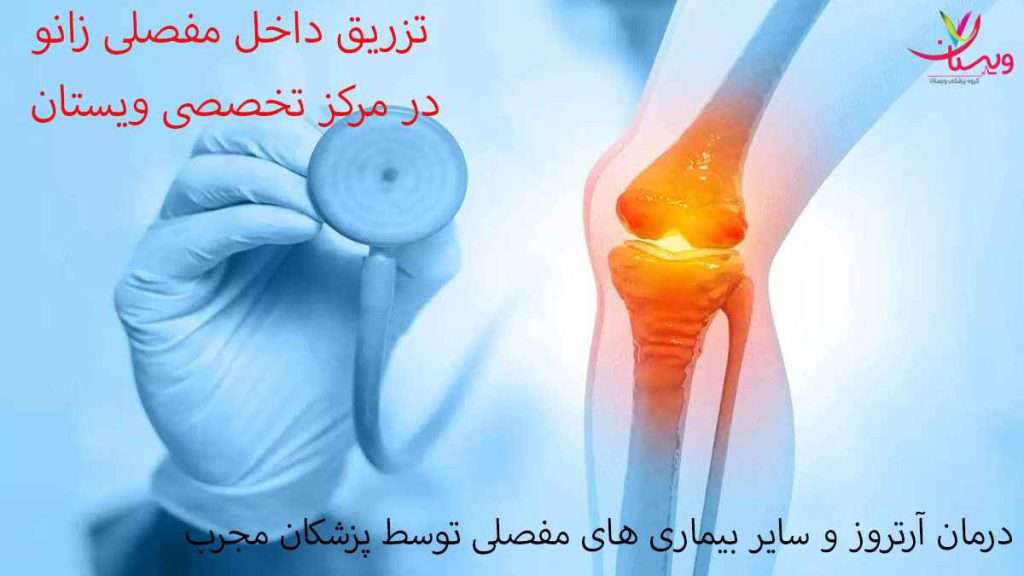 تزریق داخل مفصلی