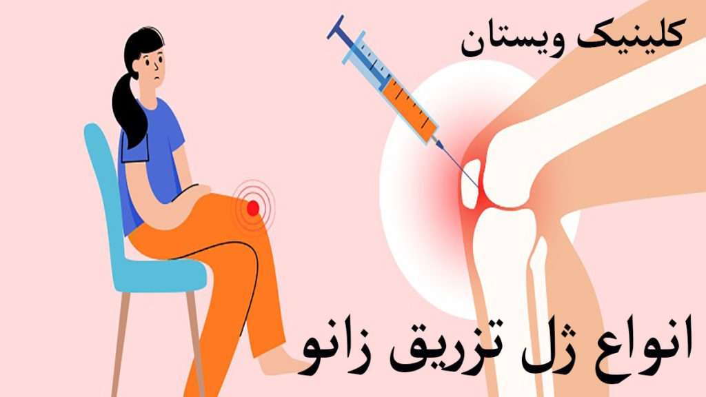 انواع تزریق ژل زانو شخص دارای زانو درد و تزریق ژل به داخل مفصل زانو نشان داده می شود