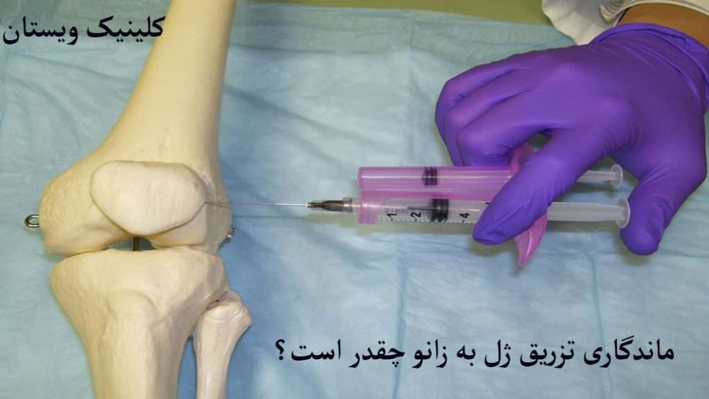 ماندگاری ژل زانو تزریق به مفصل زانو توسط پزشک متخصص