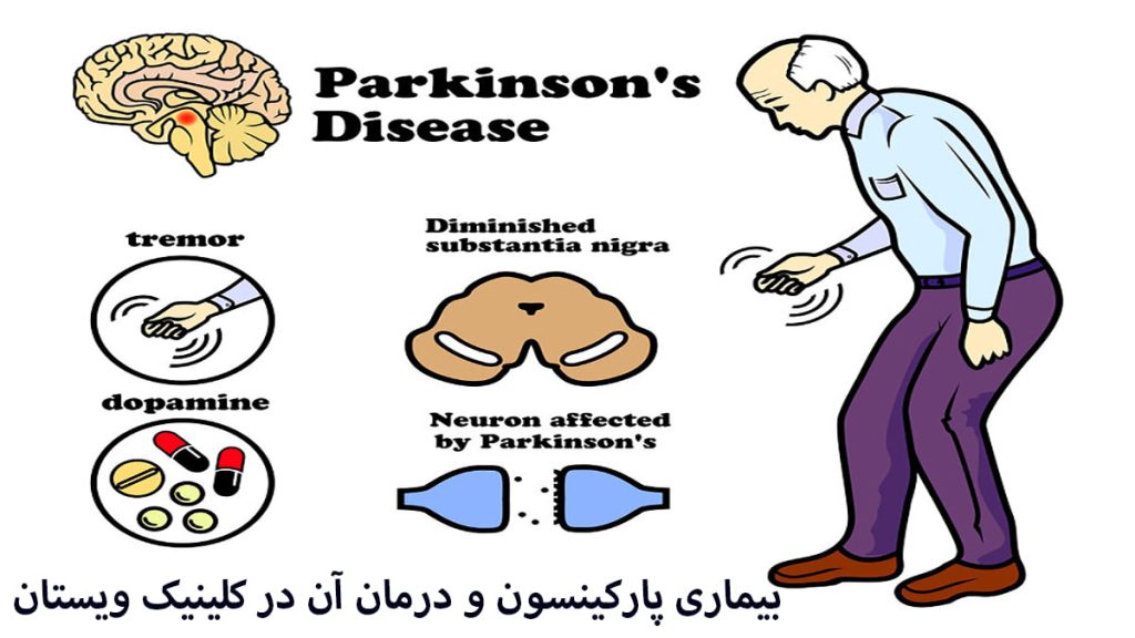 بیماری پارکینسون یک شخص سالمند مبتلا به بیماری پارکینسون نمایش داده می شود