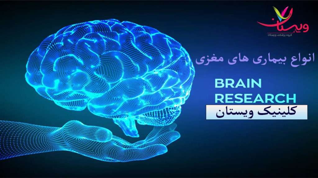 انواع بیماری های مغز و اعصاب از نظر پزشکان متخصص