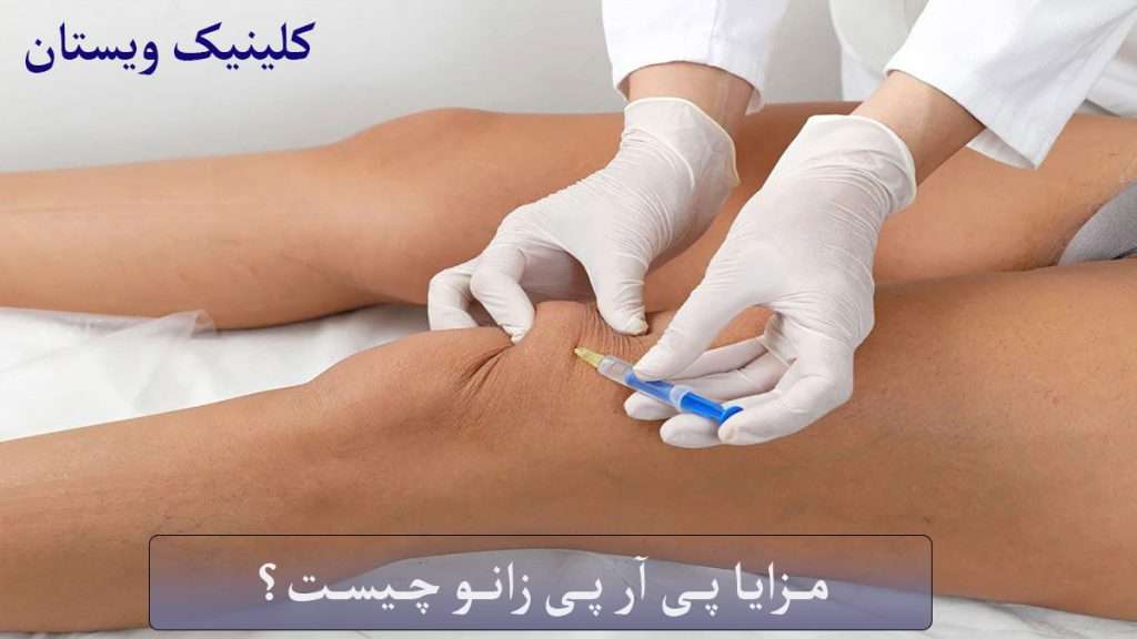 مزایای پی ار پی پزشک متخصص به زانوی فرد بیمار پی ار پی تزریق می کند