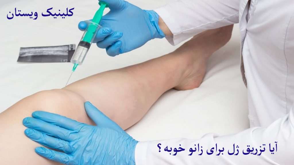 تزریق به زانو پزشک متخصص در حال تزریق ژل به زانو می باشد