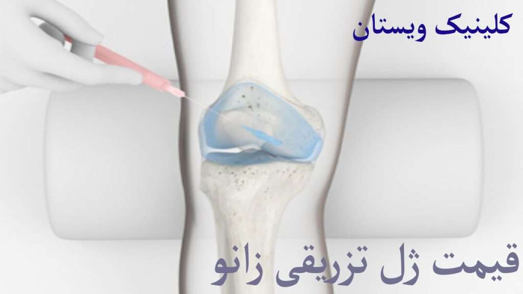 قیمت ژل زانو تزرق داخل مفصل زانو نشان داده می شود