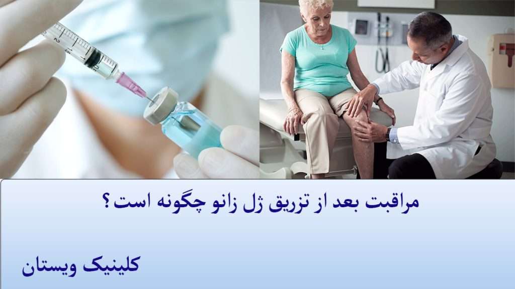 مراقبت بعد از تزریق ژل زانو پزشک در حال کمک به فرد دارای زانو درد