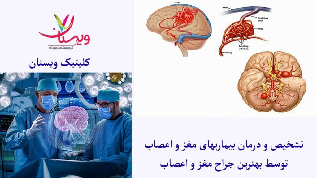 بررسی مغز و جراحی آن توسط پزشکان متخصص