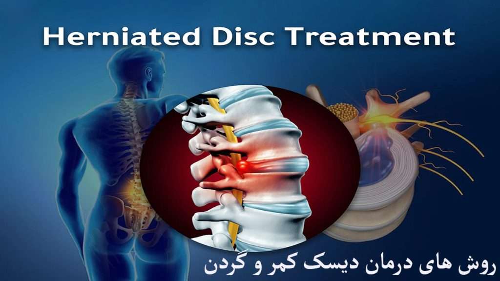 درمان دیسک گردن و کمر دیسک کمر و گردن و ستون فقرات نشان داده می شود