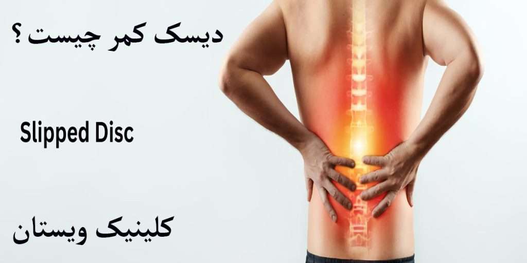 دیسک کمر شخصی دارای دیسک کمر است