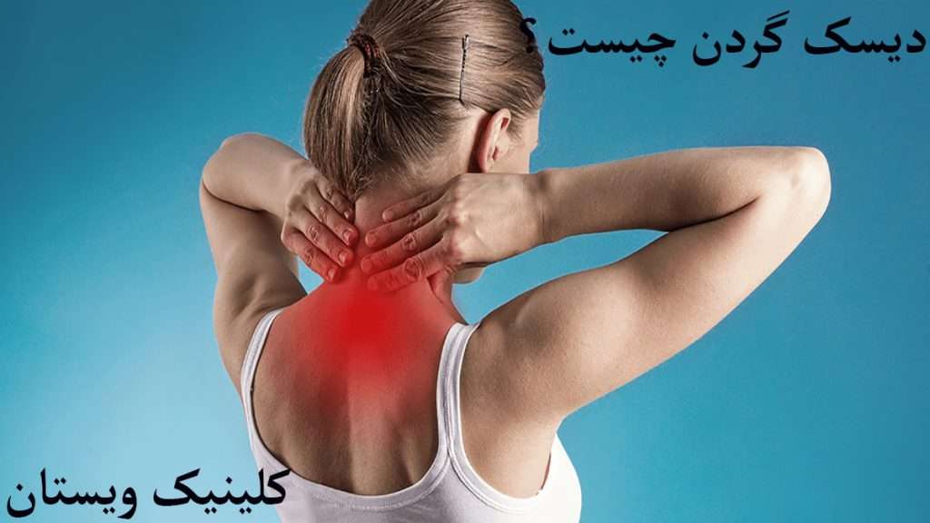 دیسک گردن شخصی دارای درد در ناحیه گردن است