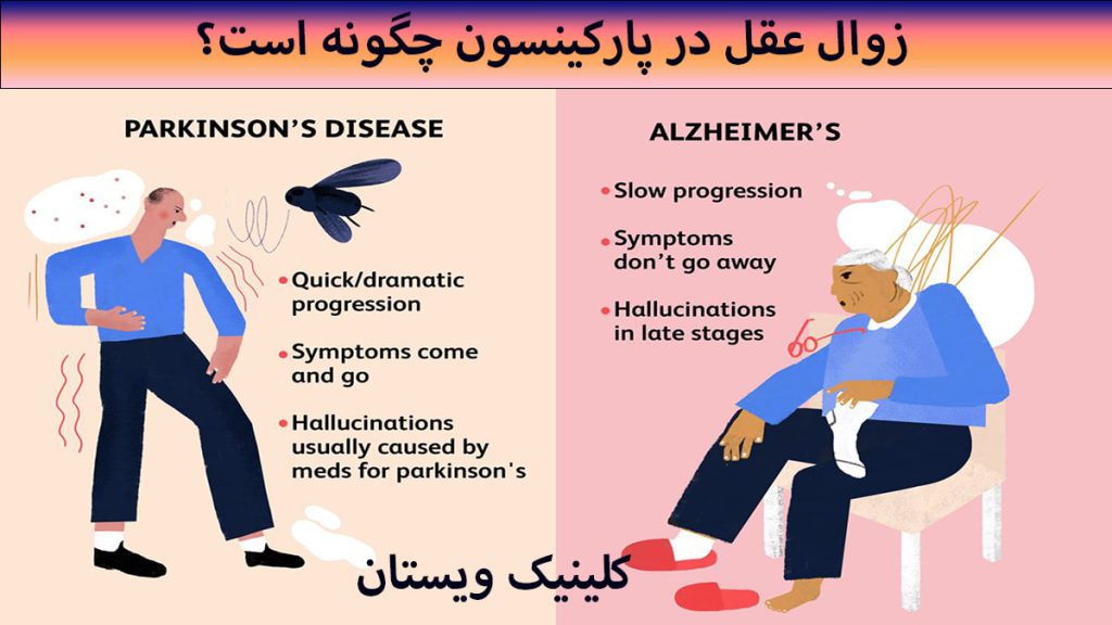 علائم زوال عقل و پارکینسون نشان داده می شود
