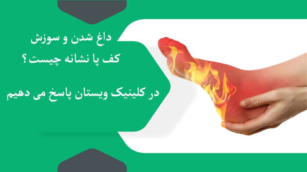 داغی و سوزش کف پار ا نشان می دهد
