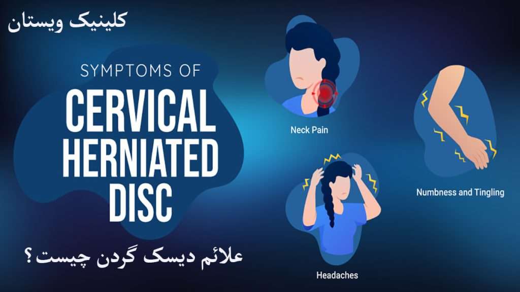 علائم دیسک گردن علائم دیسک گردن را نشان می دهد