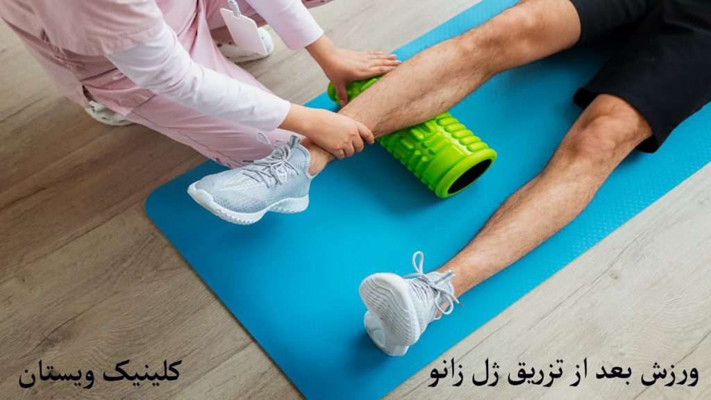 ورزش بعد از تزریق ژل به زانو شخص به کمک پزشک در حال انجام حرکات ورزشی زانو است