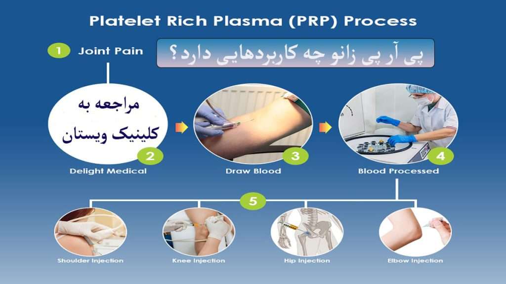 کاربرد پی ار پی مراحل استخراج پی ار پی و کاربردهای آن نمایش داده می شود