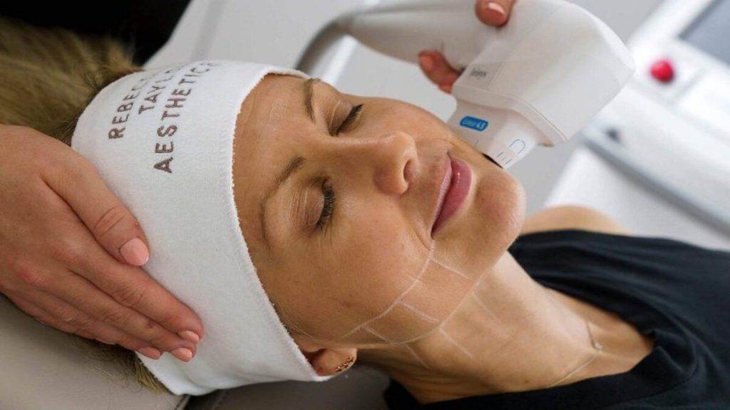 خانمی در حال انجام هایفوتراپی صورت خانمی در حال انجام هایفوتراپی صورت