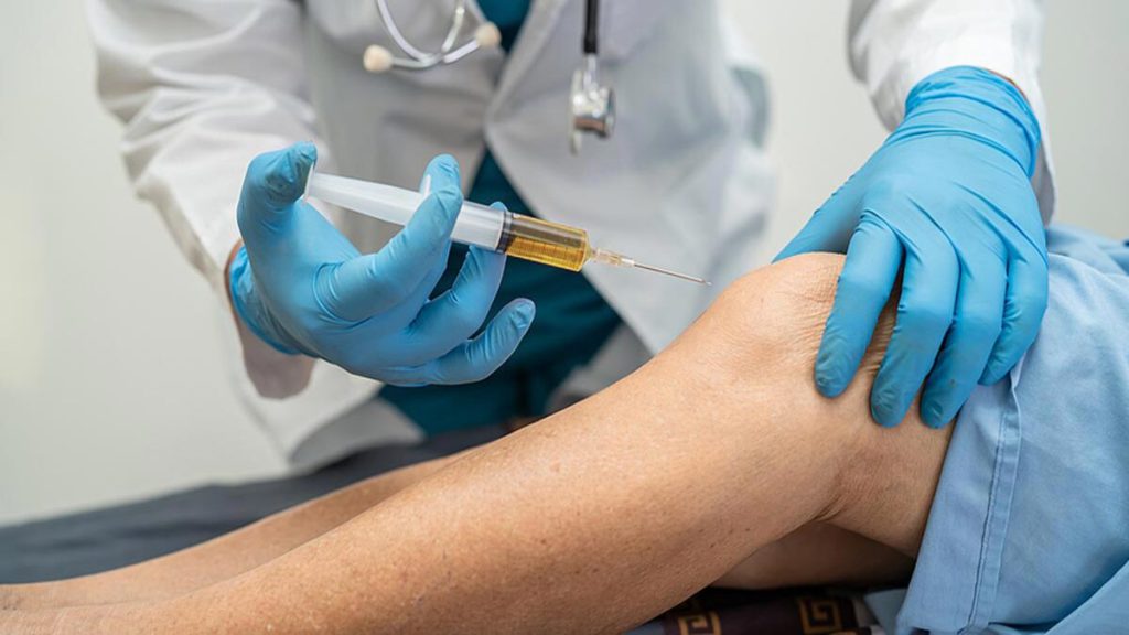 دکتر متخصص در حال انجام پی آرپی زانو برای بیمار دکتر متخصص در حال انجام پی آرپی زانو برای بیمار