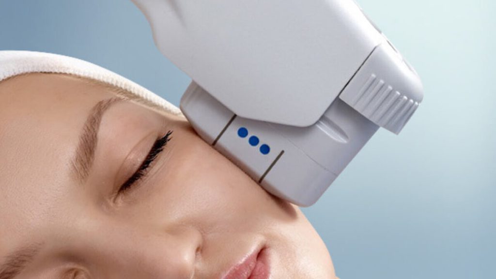 خانمی در حال انجام هایفوتراپی صورت خانمی در حال انجام هایفوتراپی صورت